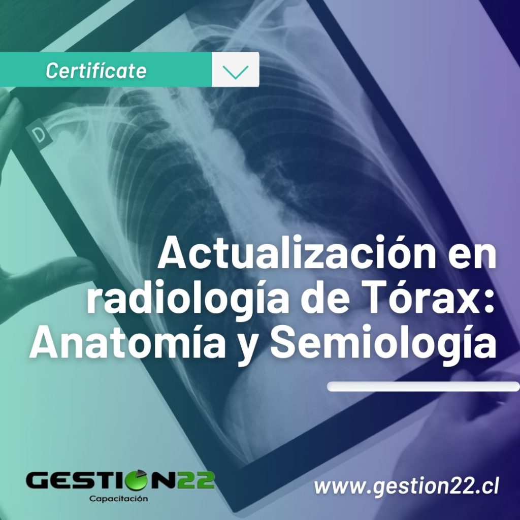 Actualización en radiología de Tórax Anatomía y Semiología